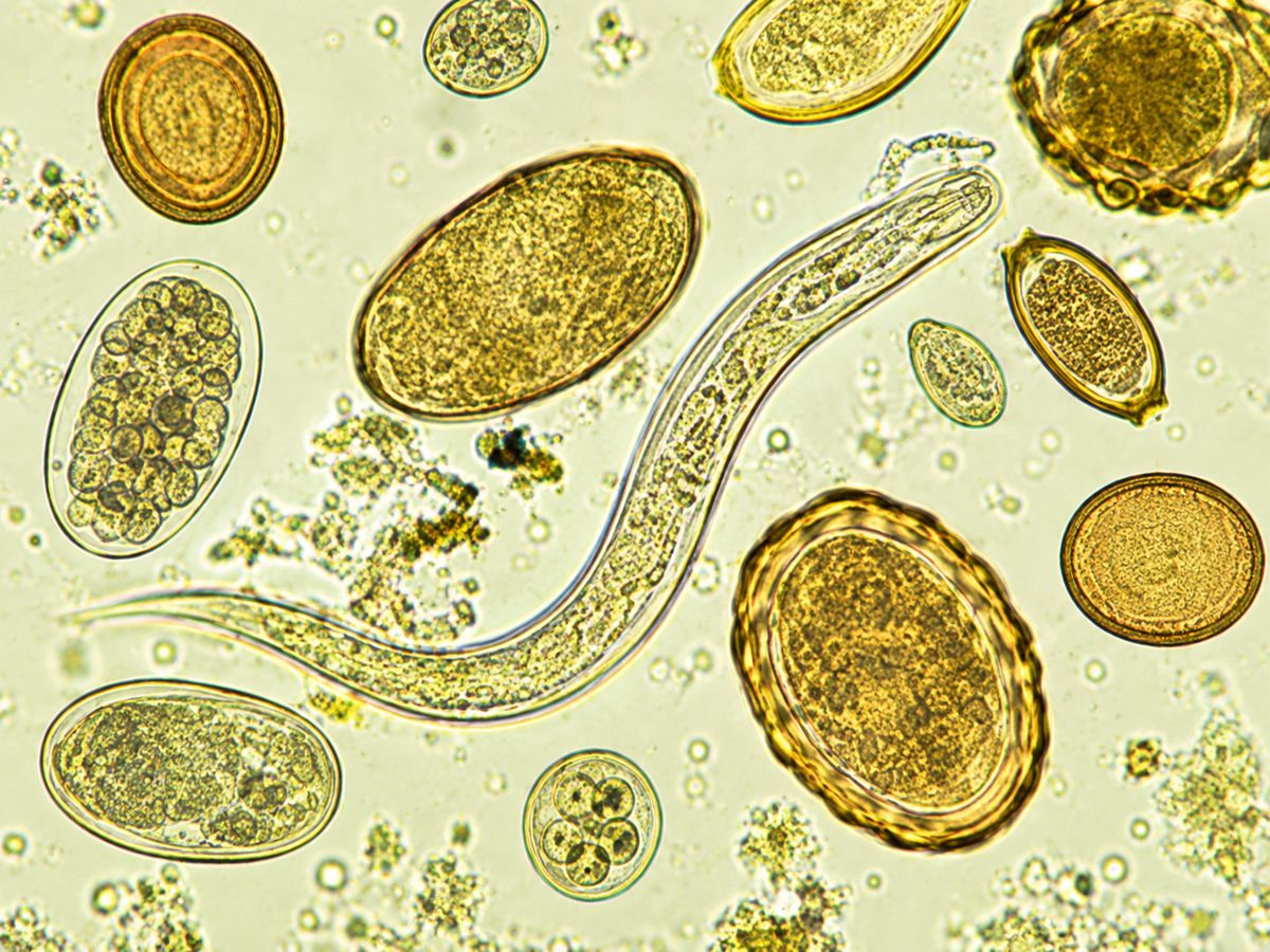Microscope view of intestinal parasites and eggs